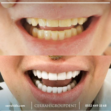 Slider image (3) Cerrahi Group Dental Clinic